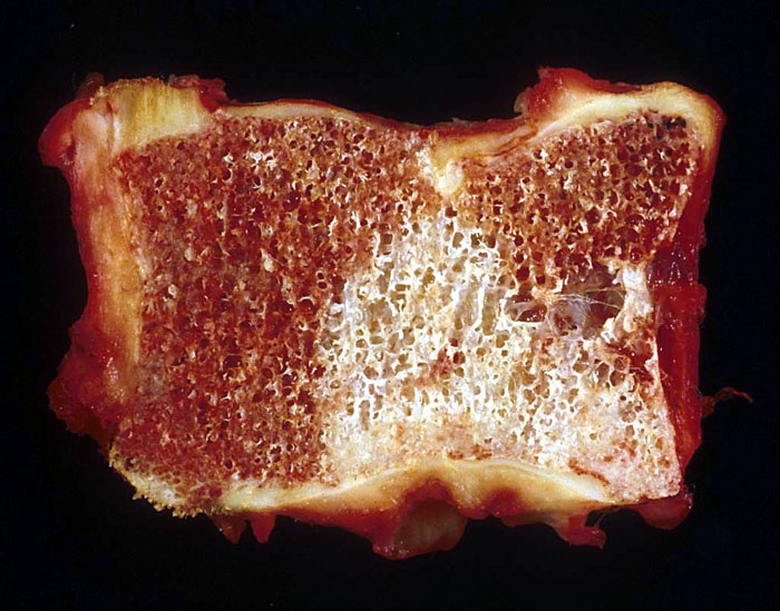 Forum Case 17 - Picture a -  Gross