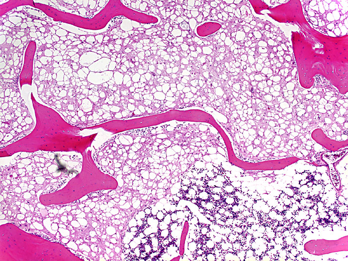 Forum Case 17 - Picture b -  4x