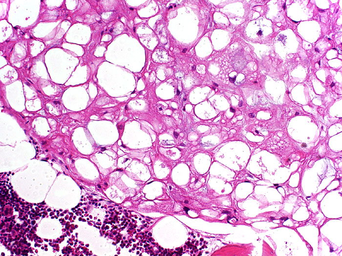 Forum Case 17 - Picture d -  20x