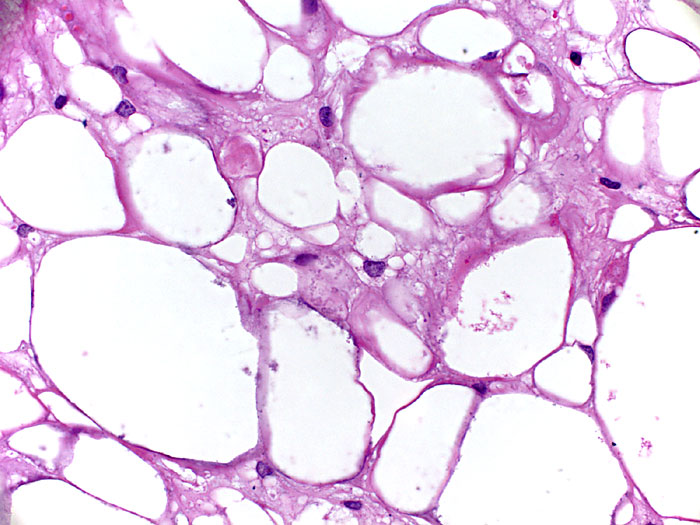 Forum Case 17 - Picture e -  40x